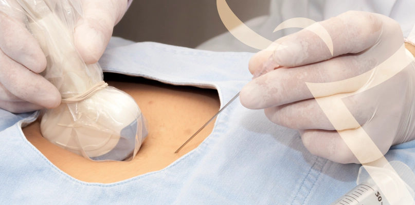 Imagem Infiltração Guiada por Ultrassom