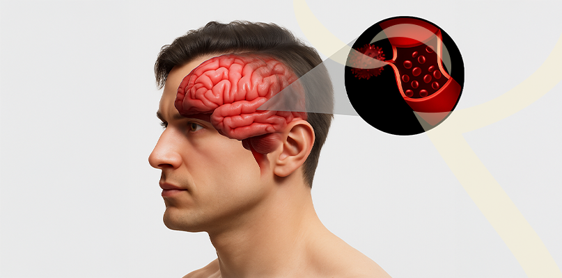 Imagem Infiltração Guiada por Ultrassom