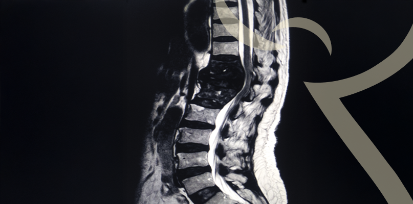 Imagem Infiltração Guiada por Ultrassom